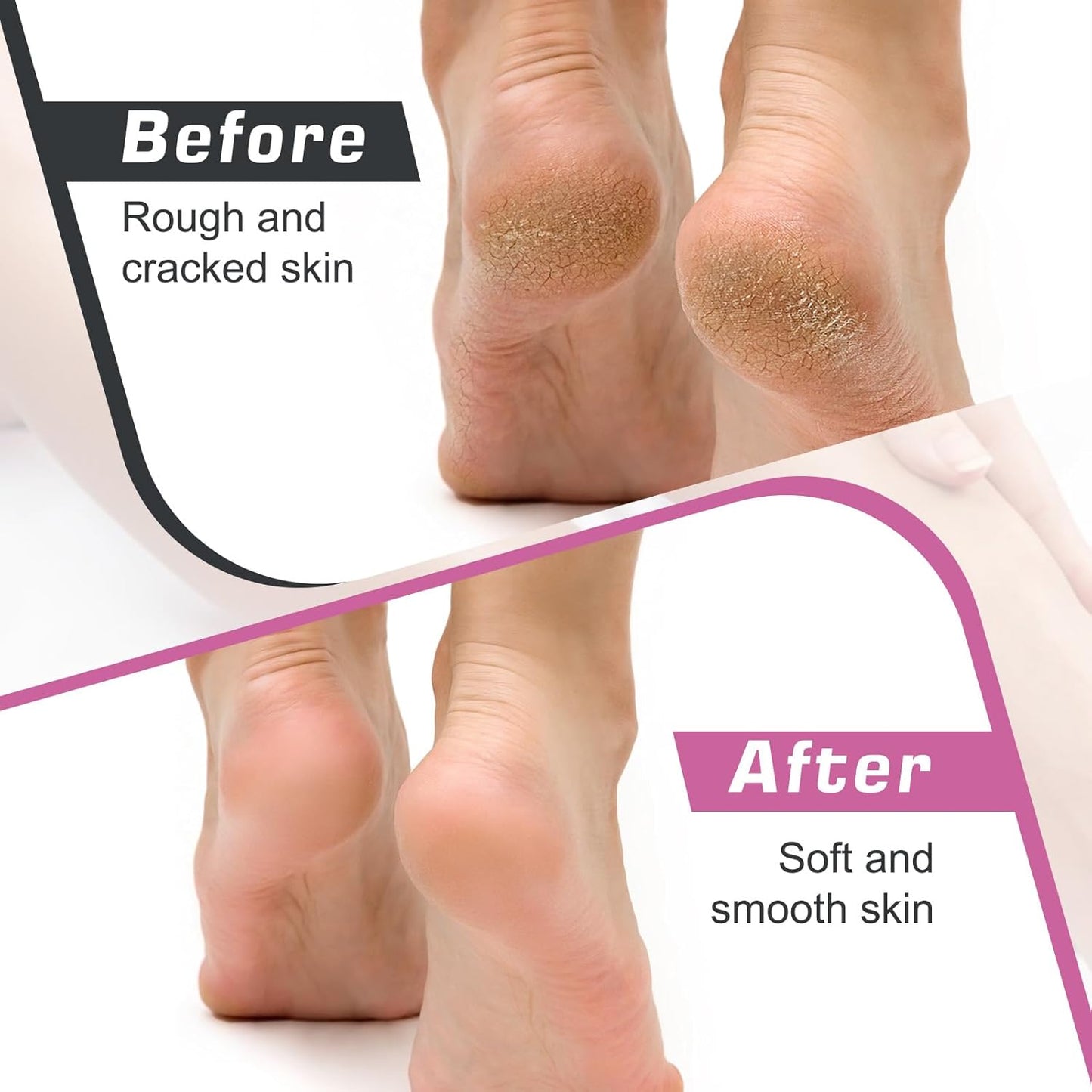 Electric Callus Remover FSA or HSA Eligible, Foot Nail File Grinder Tool with Speed Controller and 60PCS Replacement Sandpaper Disk, Pedicure Tool Feet Scrubber for Dead Dry Crack Skin Calluses